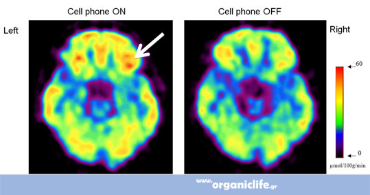 18-i-aktonovolia-ton-kin-4g