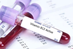 12-b12-9