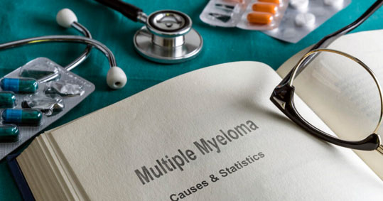 19-mieloma