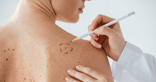 31-hartografisi-spilon